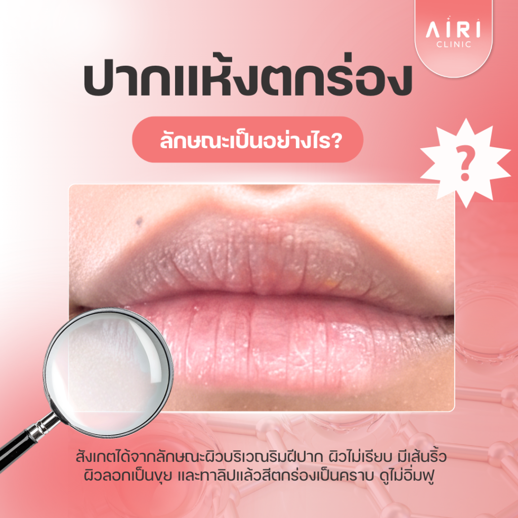 ปากเเห้งตกร่อง