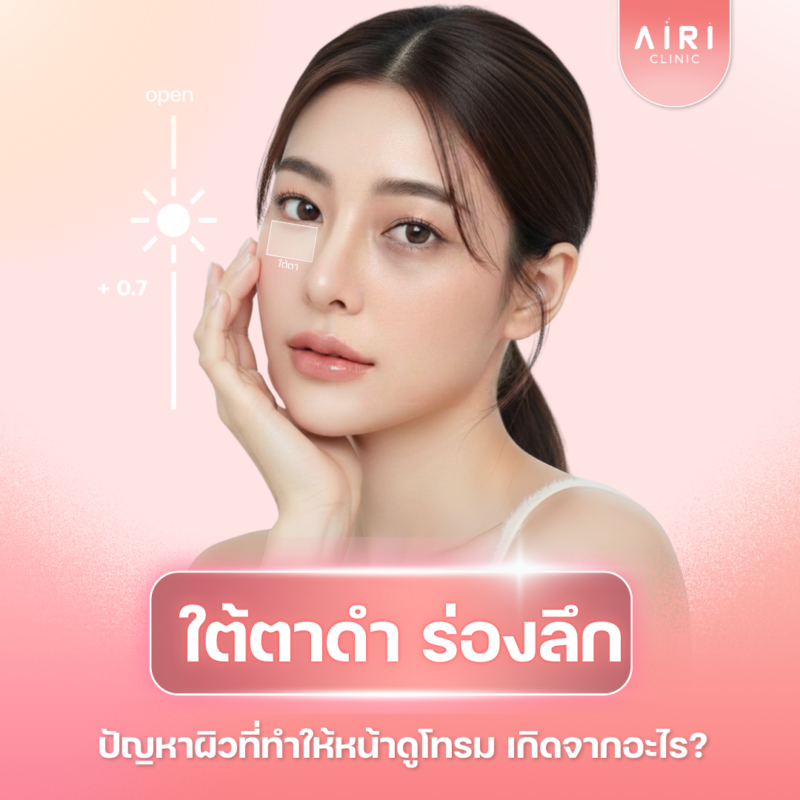 ใต้ตาดํา ร่องลึก