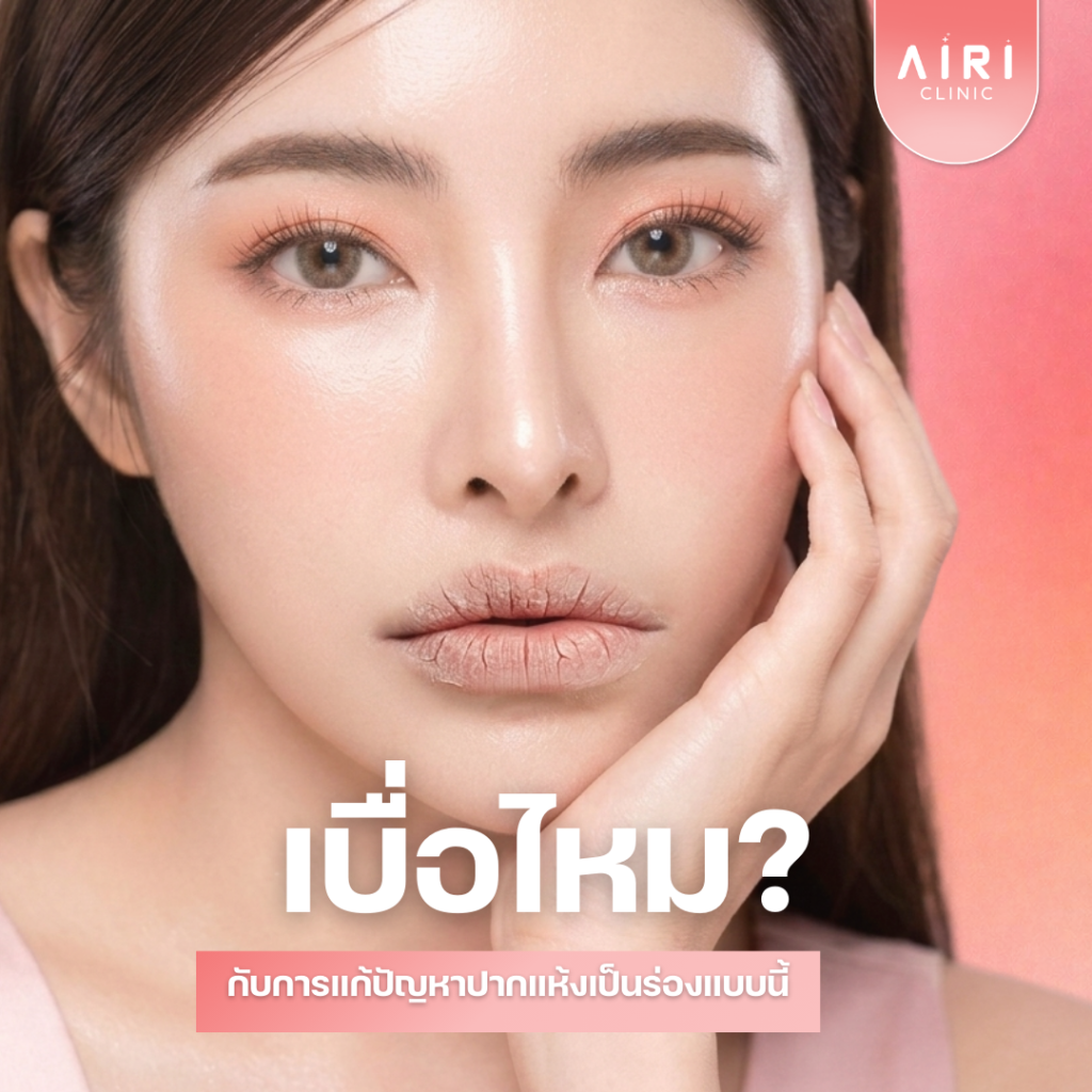 ปากเเห้งตกร่อง เบื่อไหมกับปัญหาเหล่านี้