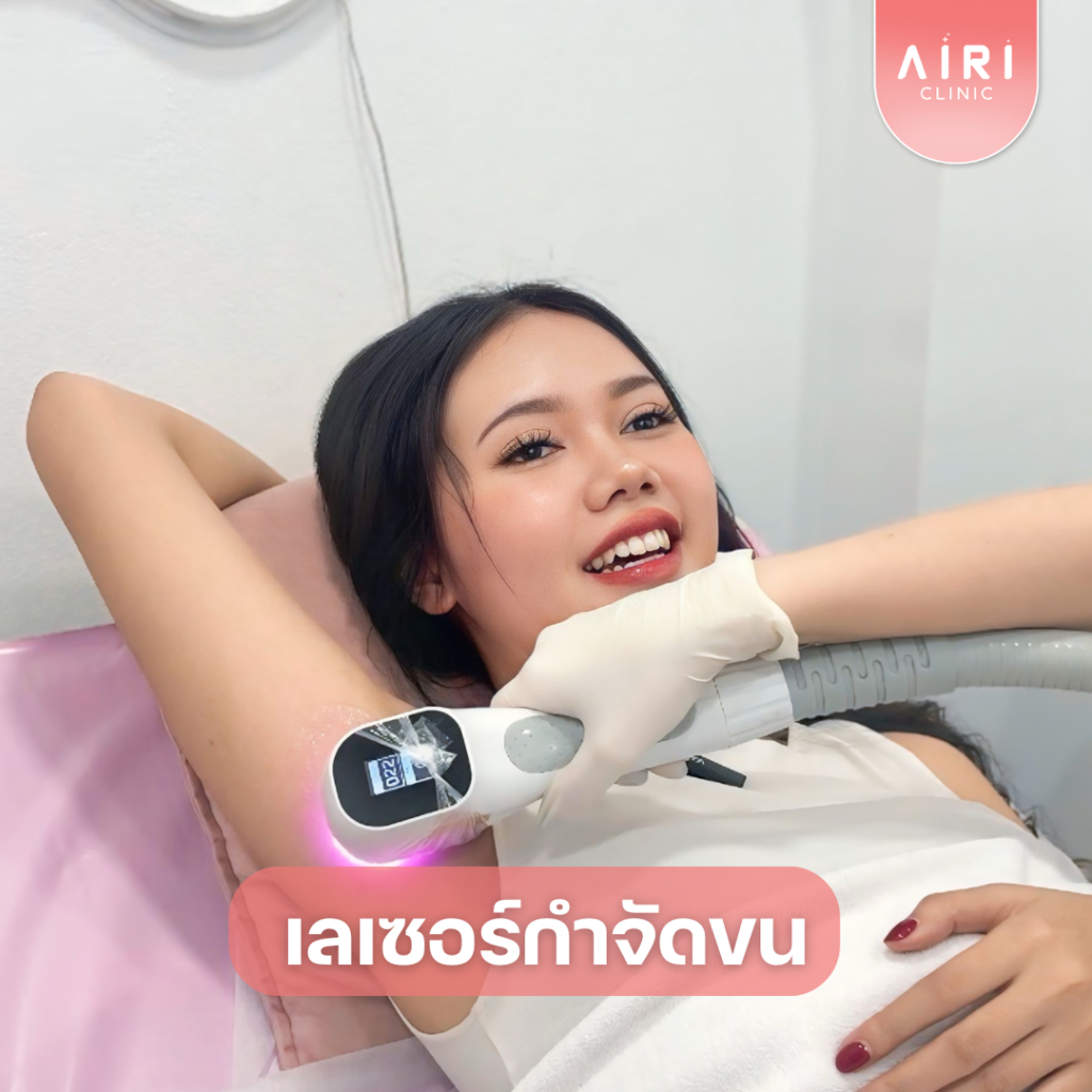 เลเซอร์